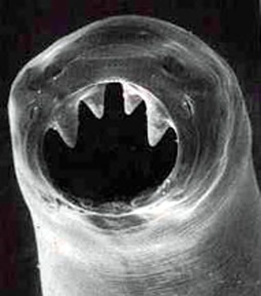 http://i243.photobucket.com/albums/ff314/wilbercuntlicker/hookworms.jpg